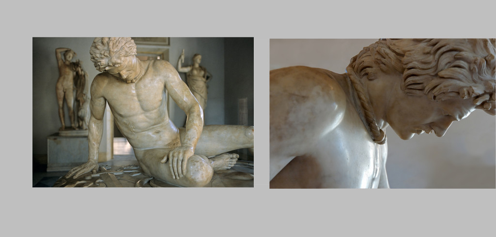 dyinggaul