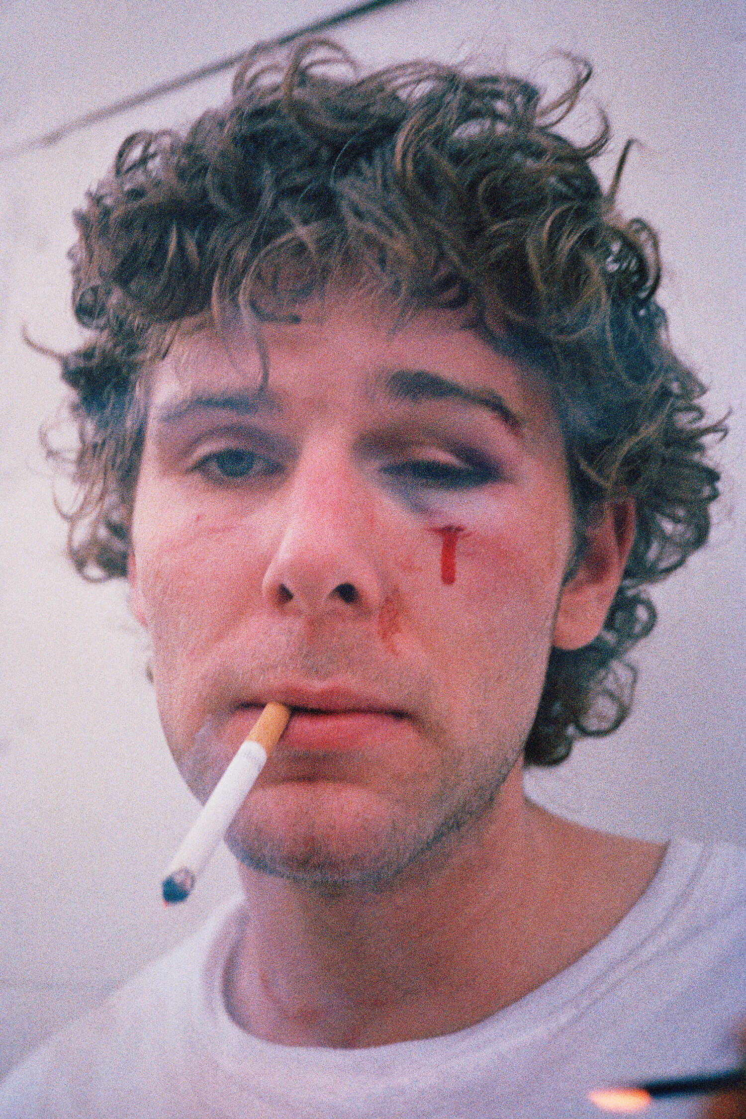 Dan (Bloody Eye), 2002. C-print, 45 x 30 inches. © Ryan McGinley.