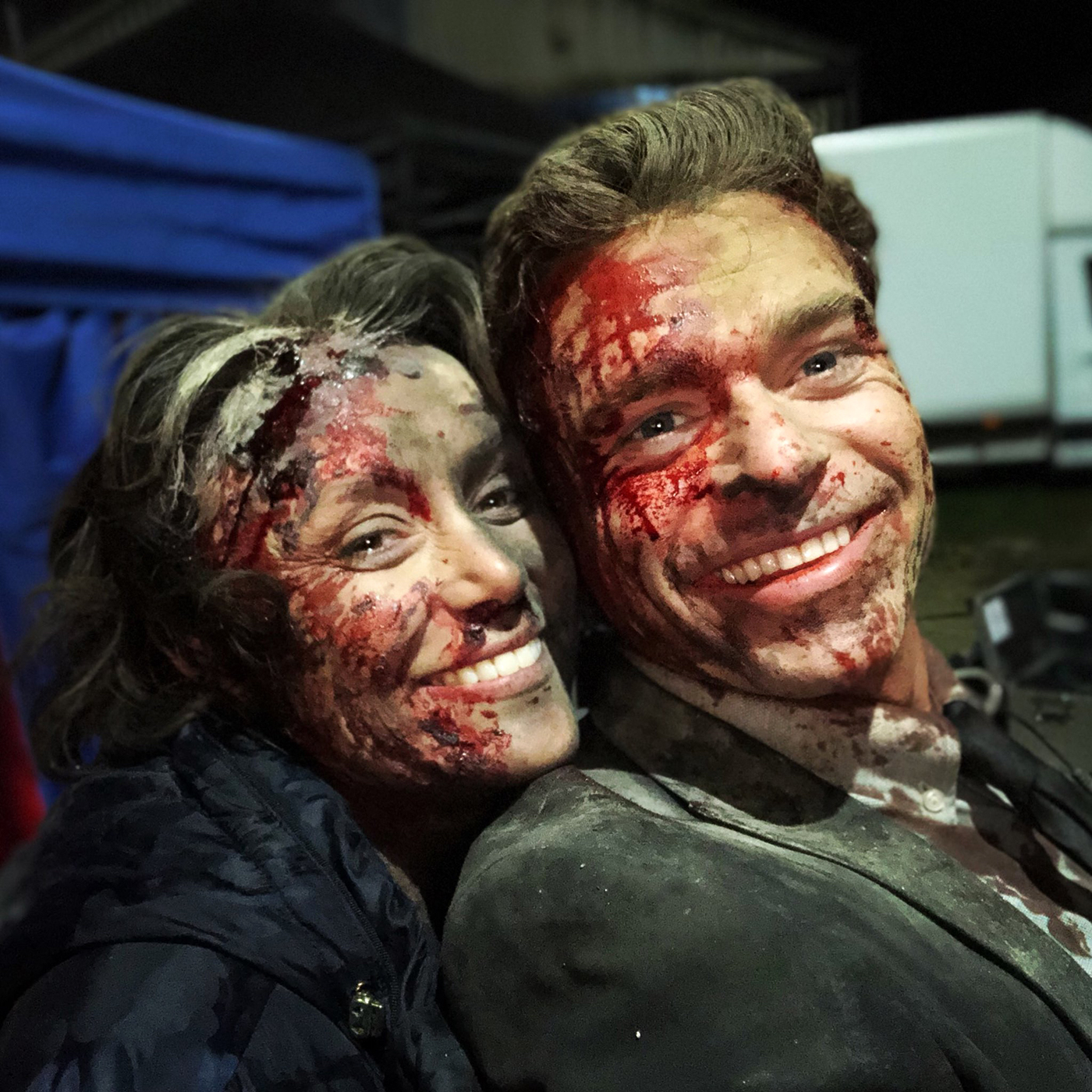 Richard Madden and Keeley Hawes bloody faces
